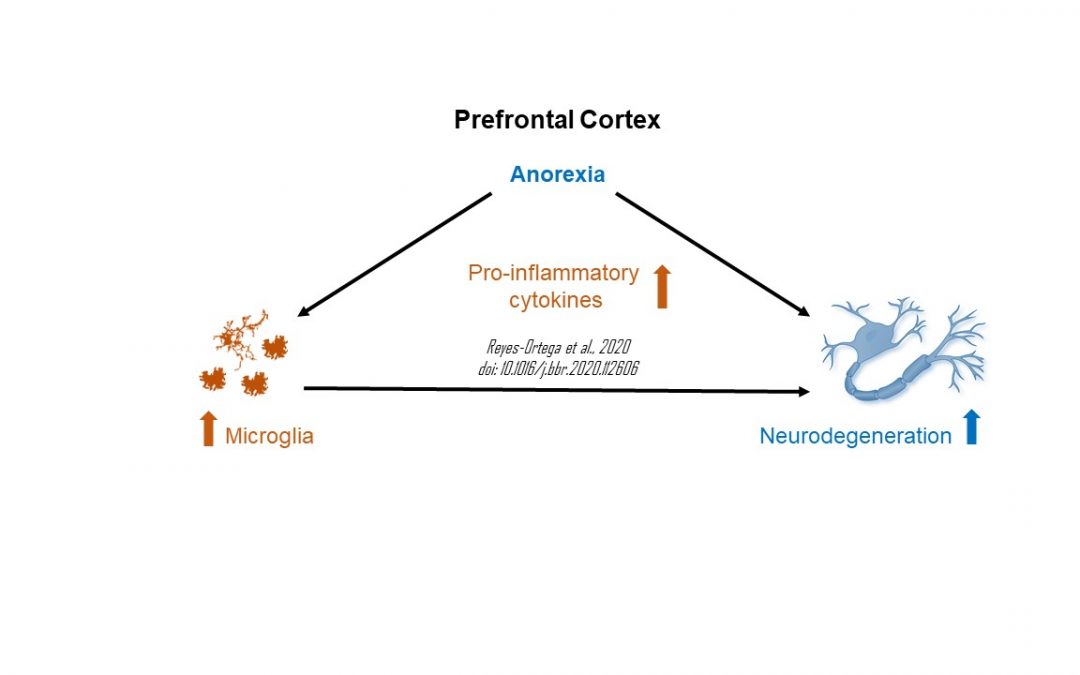 Anorexia induces a microglial associated pro-inflammatory environment and correlates with neurodegeneration in the prefrontal cortex of young female rats