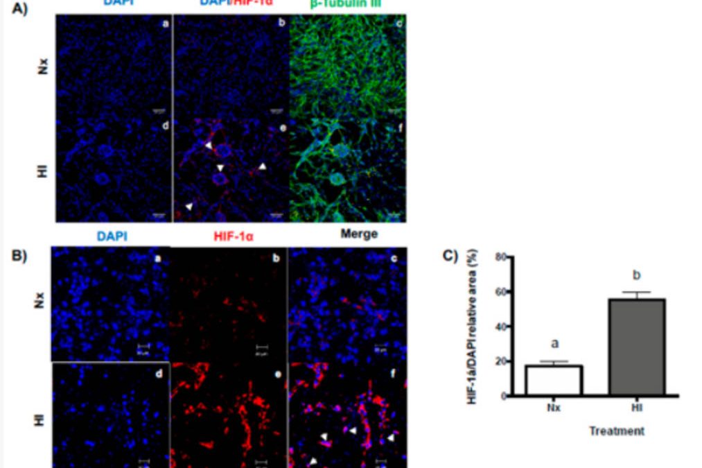 Neuroprotective Effects of Growth Hormone (GH) and Insulin-Like Growth Factor Type 1 (IGF-1) after Hypoxic-Ischemic Injury in Chicken Cerebellar Cell Cultures