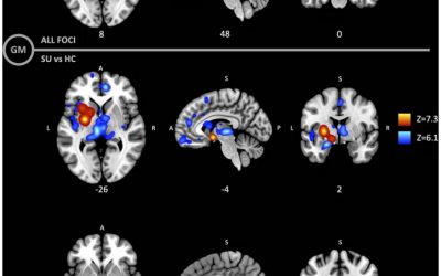 Gray and white matter morphology in substance use disorders: a neuroimaging systematic review and meta-analysis