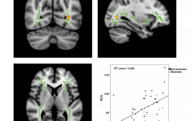 Audiovisual structural connectivity in musicians and non-musicians: a cortical thickness and diffusion tensor imaging study