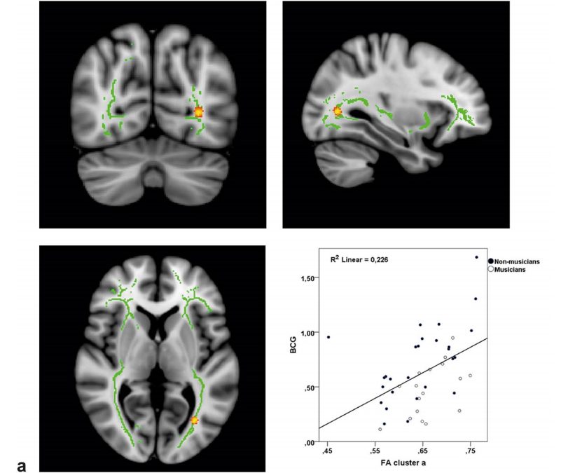 Audiovisual structural connectivity in musicians and non-musicians: a cortical thickness and diffusion tensor imaging study