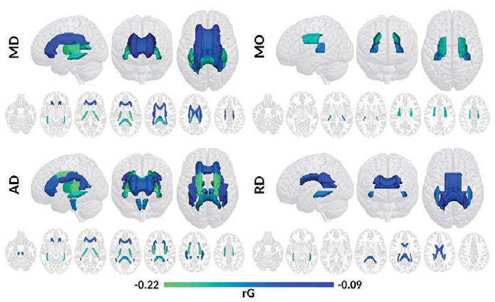Evidence of Genetic Overlap Between Circadian Preference and Brain White Matter Microstructure
